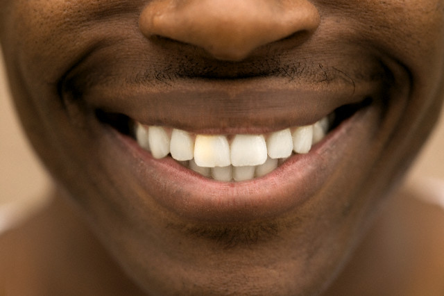 9 Things Thy Teeth Want You To Stop Doing Thyblackman