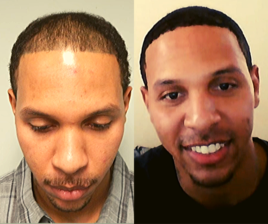 The Common Signs Of Aging And How To Prevent Them Thyblackman